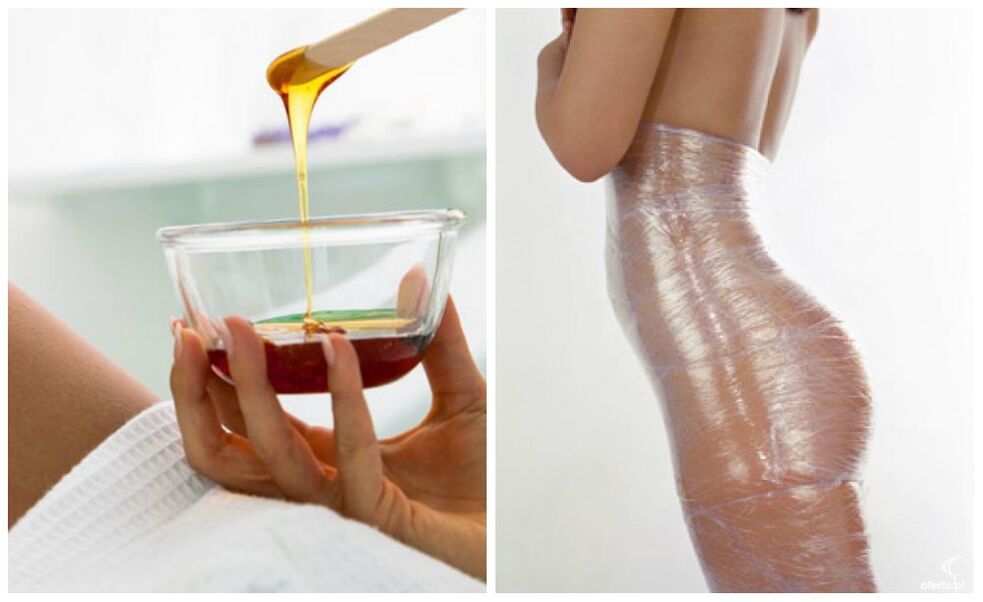 वजन घटाने के लिए बॉडी रैप्स